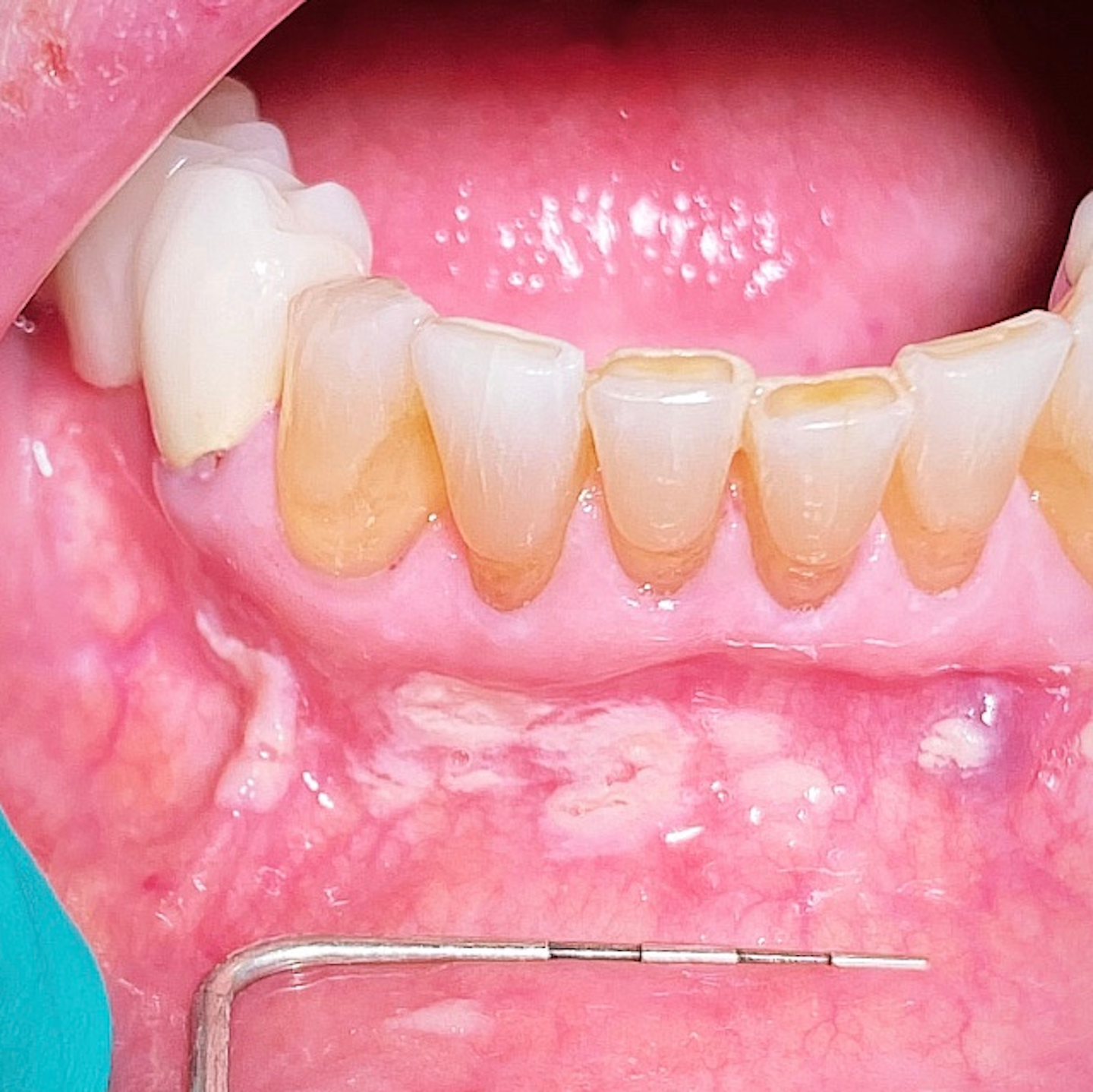 Covid 19 Stress 2020 Oral Pathology Dental Economics