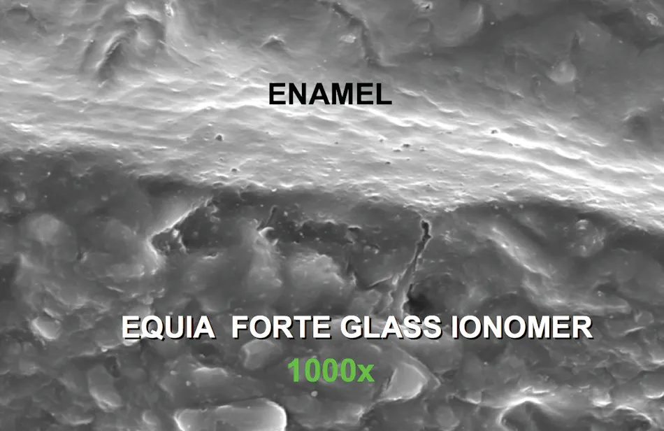 Making dental composites better and longer lasting Dental Economics