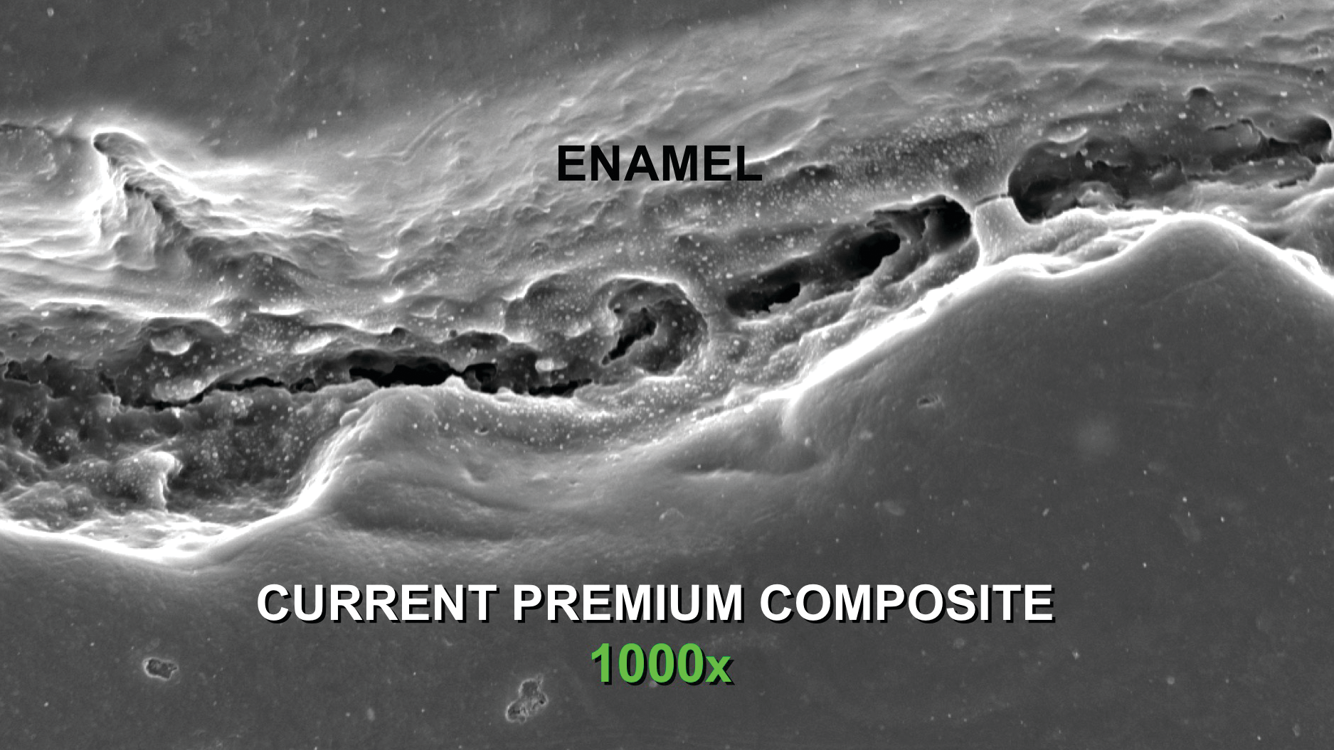 Figure 1: All composite restorations leak at the prep margins as shown in this in vivo electron microscope photo at three years of service