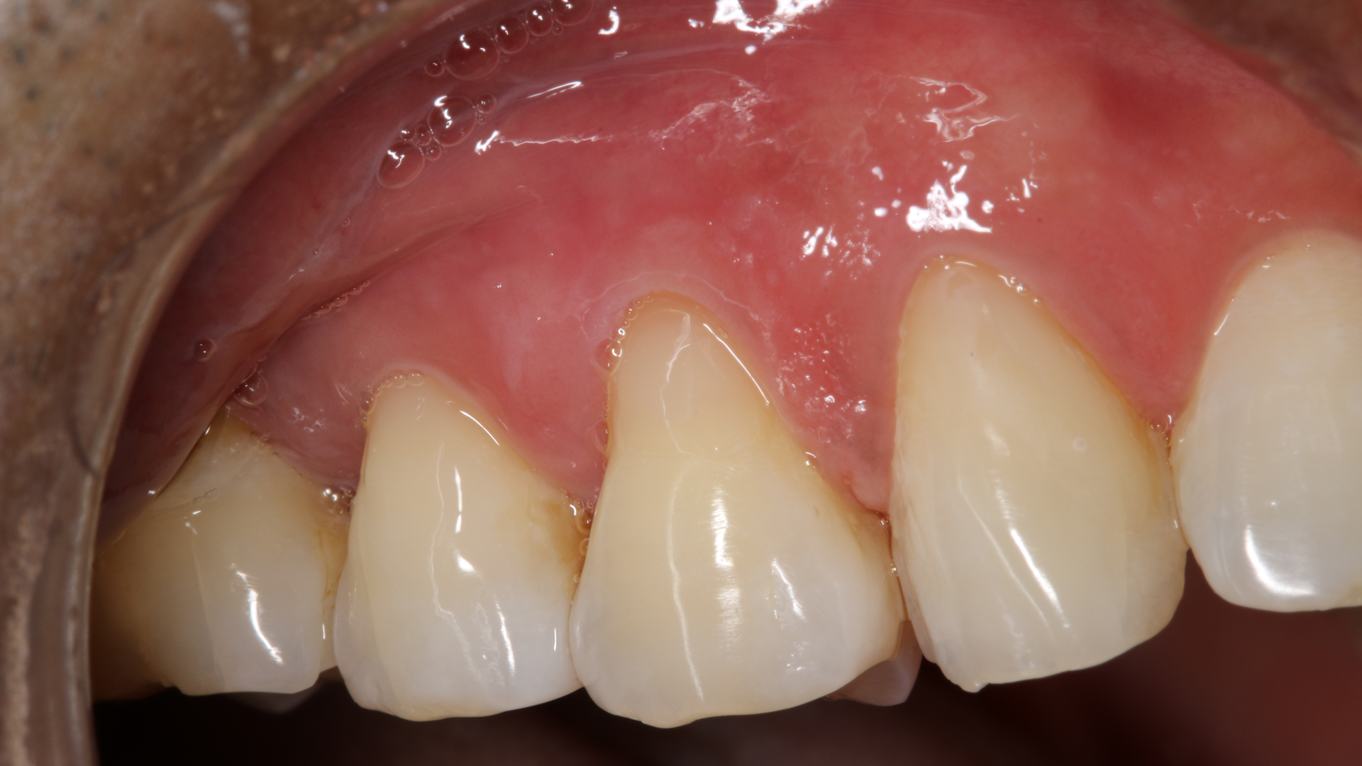 2101 De Cpey P05 5feb8d72b7ad0