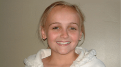 Figure 1: This is one of my grandchildren. I have followed her oral care since her birth. She has had systemic and topical fluoride, sealants, and good home care. She has lived in an area with a nonfluoridated water supply all of her life and is now a 30-year-old registered nurse. Unlike many children, she has had only one minor class I lesion. Such a situation is possible but not probable without the use of fluoride-containing procedures, a reasonably healthy diet, and good oral hygiene. Figure 1: This is one of my grandchildren. I have followed her oral care since her birth. She has had systemic and topical fluoride, sealants, and good home care. She has lived in an area with a nonfluoridated water supply all of her life and is now a 30-year-old registered nurse. Unlike many children, she has had only one minor class I lesion. Such a situation is possible but not probable without the use of fluoride-containing procedures, a reasonably healthy diet, and good oral hygiene.