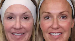 Figure 1: Before and after photos, including dental and facial esthetics, are powerful drivers for attracting new patients.