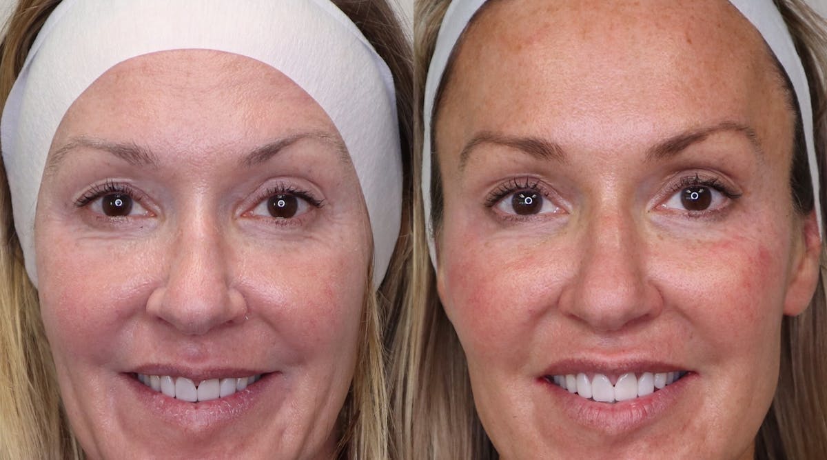 Figure 1: Before and after photos, including dental and facial esthetics, are powerful drivers for attracting new patients.