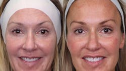 Figure 1: Before and after photos, including dental and facial esthetics, are powerful drivers for attracting new patients. Figure 1: Before and after photos, including dental and facial esthetics, are powerful drivers for attracting new patients.