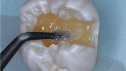 2103 De Cchr P02 60397e64c218b 2103 De Cchr P02 60397e64c218b