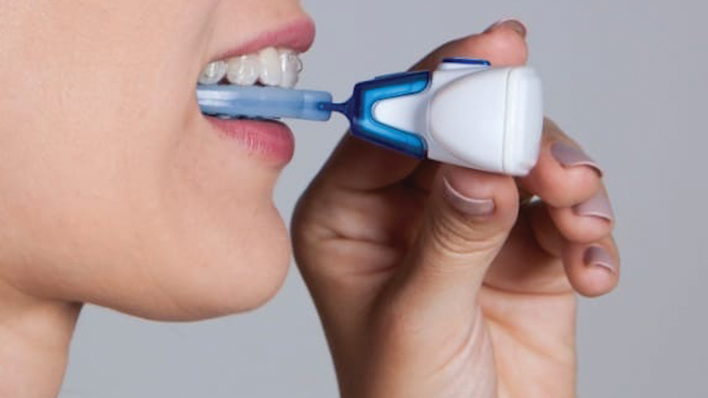 Microosteoperforations, VPro vibration device, and aligner therapy can