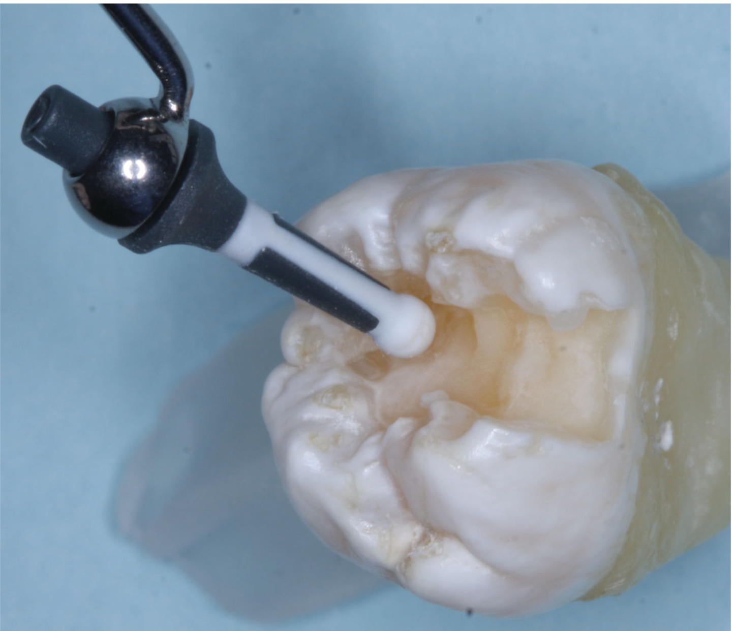 Preventive dental procedures assigned to competent staff members can be