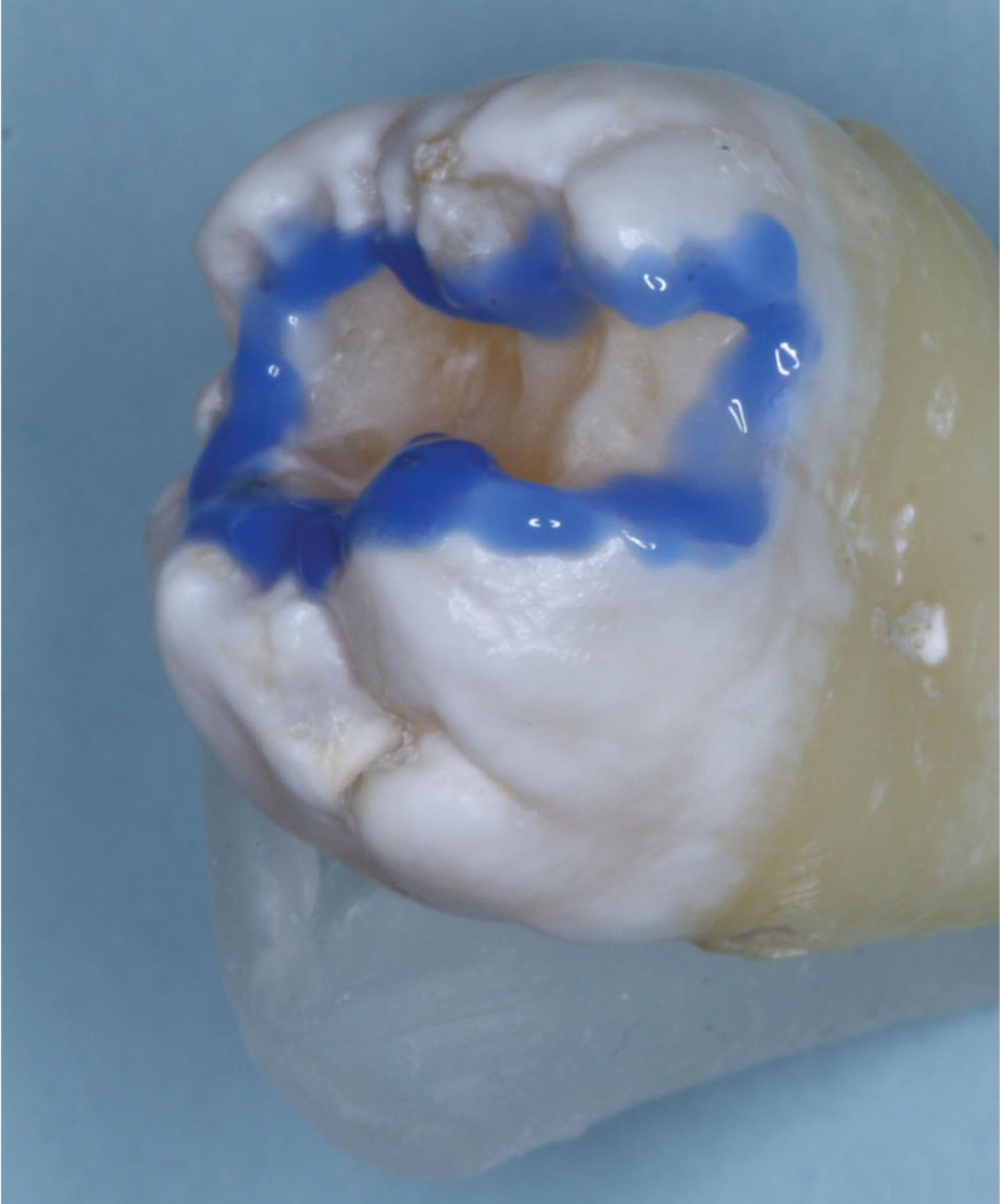 Preventive dental procedures assigned to competent staff members can be