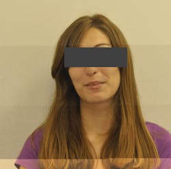 Figure 1: Patient is struggling and uncomfortable Figure 1: Patient is struggling and uncomfortable