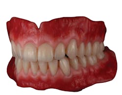 Figure 11: 3D printed dentures designed and produced by Arian Deutsch MDT.