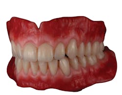 Figure 11: 3D printed dentures designed and produced by Arian Deutsch MDT. Figure 11: 3D printed dentures designed and produced by Arian Deutsch MDT.