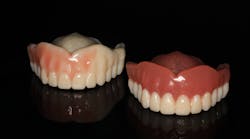 3D printed denture examples: Left denture is printed in tooth shade A1 and custom stains used to paint on soft tissue. Right denture is printed in tooth shade and gingiva is printed in gingival shade.
