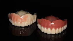 3D printed denture examples: Left denture is printed in tooth shade A1 and custom stains used to paint on soft tissue. Right denture is printed in tooth shade and gingiva is printed in gingival shade. 3D printed denture examples: Left denture is printed in tooth shade A1 and custom stains used to paint on soft tissue. Right denture is printed in tooth shade and gingiva is printed in gingival shade.