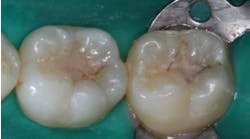 Figure 1: Failed sealants are a common occurrence. Failure can be avoided as described in this article.