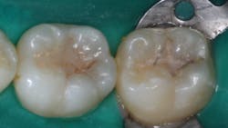 Figure 1: Failed sealants are a common occurrence. Failure can be avoided as described in this article.