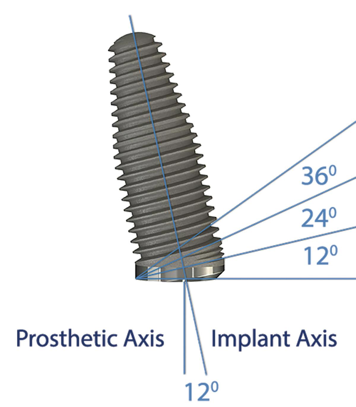 Figure 1: Diagram of implant angle corrections for Co-Axis Implants