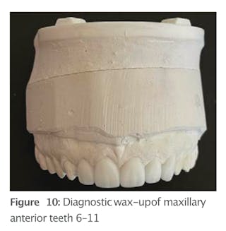 RESTORATIVE DESIGN & PRACTICAL OCCLUSIO… Occlusion in Clinical Practice | Spear Education