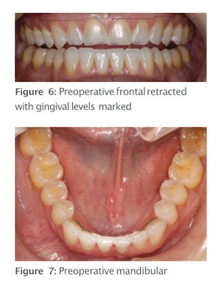 RESTORATIVE DESIGN & PRACTICAL OCCLUSIO… Amazon.com: Functional Occlusion: From TMJ to Smile Design