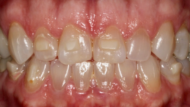 2107 De Caad P09 60e4bf4a765aa