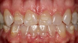 2107 De Caad P09 60e4bf4a765aa 2107 De Caad P09 60e4bf4a765aa