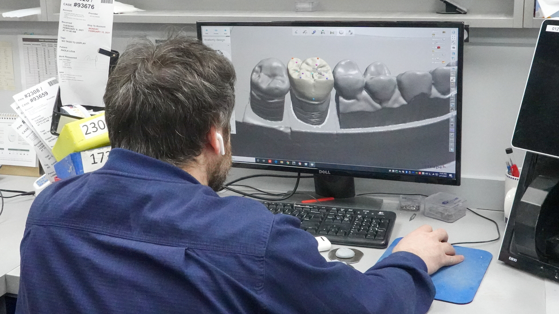 cad cam in dentistry cad cam in dentistry