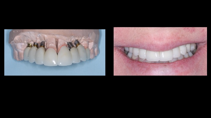 2108 De Cchr P04 610ac8147e8de