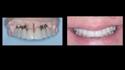 2108 De Cchr P04 610ac8147e8de 2108 De Cchr P04 610ac8147e8de