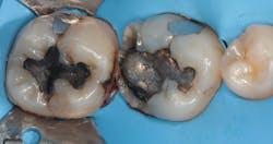 Figure 2: Isolation Figure 2: Isolation