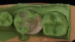 Figures 6a–6c: Initial layering Figures 6a–6c: Initial layering