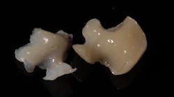 Figure 8: Intaglio Figure 8: Intaglio