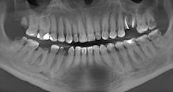 Figure 3: Initial pan-x Figure 3: Initial pan-x