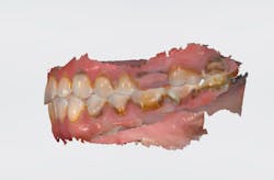 Figure 5: Trios scan (left) Figure 5: Trios scan (left)