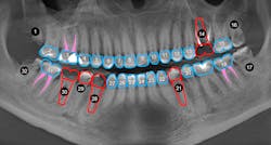 Figure 6: Conventional path Figure 6: Conventional path