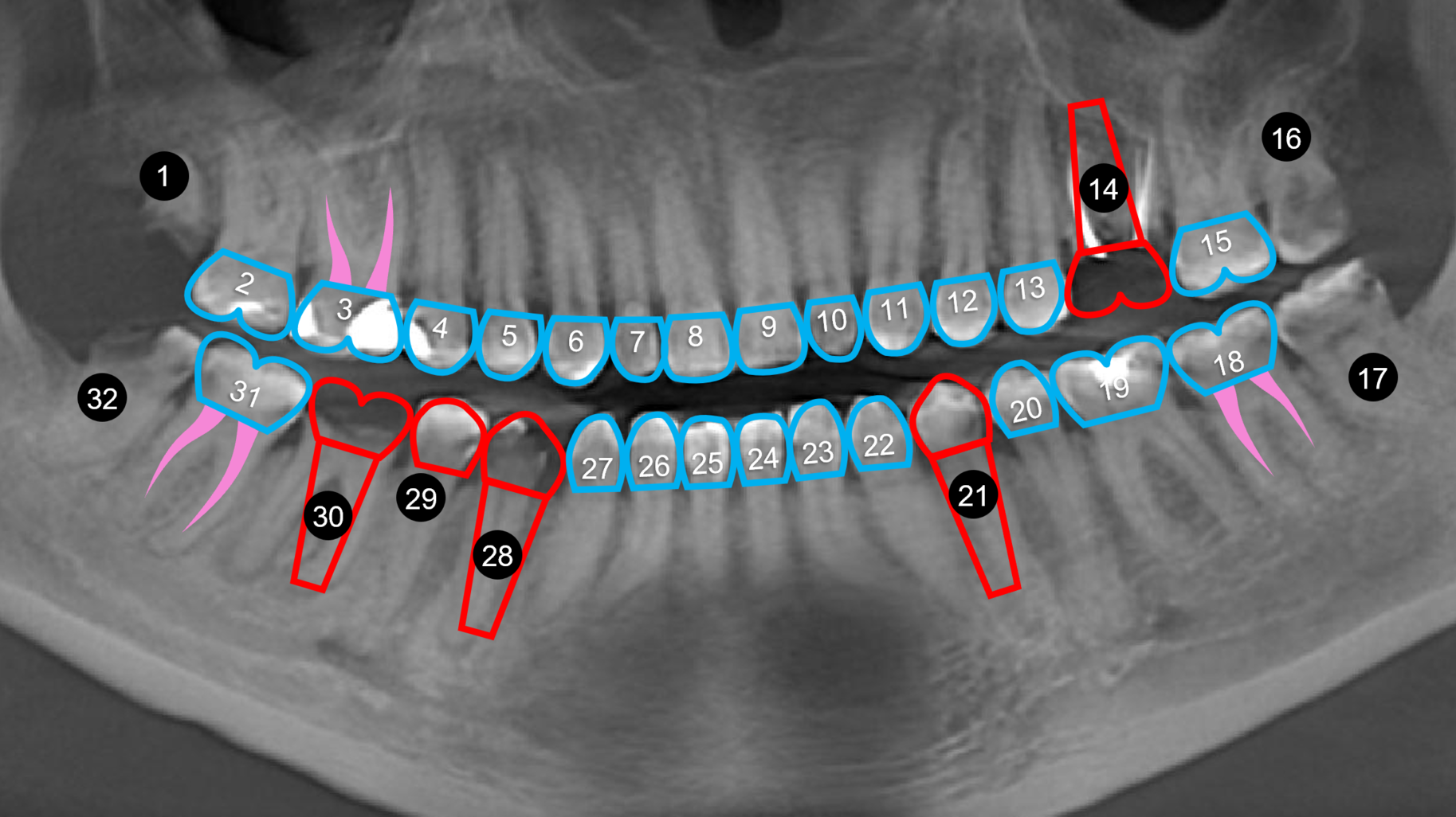 Image 7 Conventional Path 61843d164363a