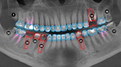 Image 7 Conventional Path 61843d164363a Image 7 Conventional Path 61843d164363a