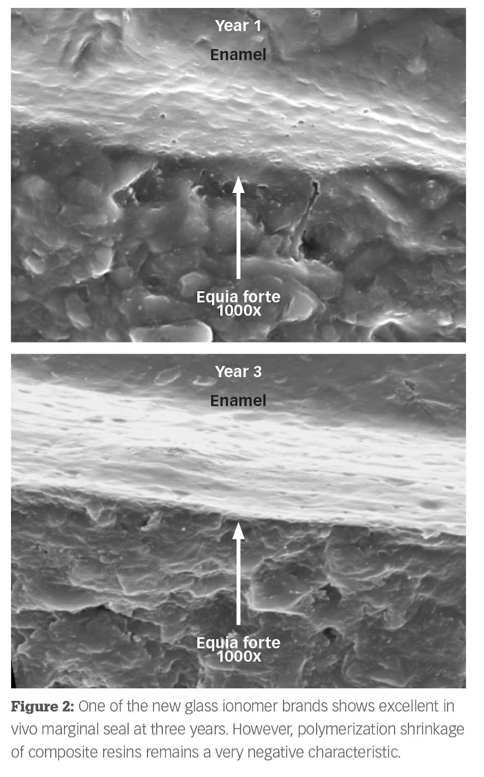 Are flowable composites adequate restorations? Dental Economics