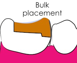 Figure 6: A composite placed in one increment will only have one opportunity to form a meniscus at the free surface area. Figure 6: A composite placed in one increment will only have one opportunity to form a meniscus at the free surface area.