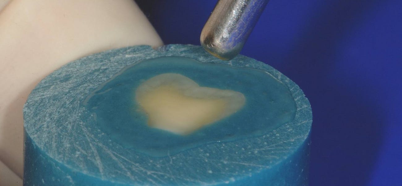Figure 3: Thinning adhesive to stretched plastic wrap thickness and blowing air across specimen to allow time for alcohol to evaporate will give best results with bonding. Figure 3: Thinning adhesive to stretched plastic wrap thickness and blowing air across specimen to allow time for alcohol to evaporate will give best results with bonding.