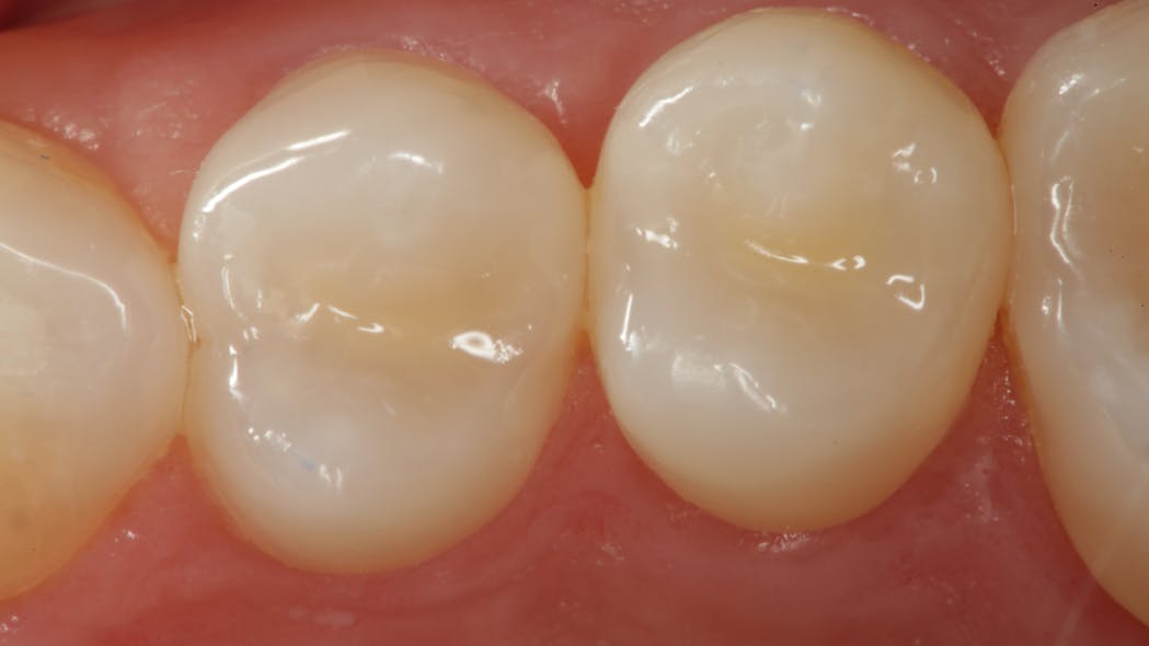 Methacrylatefunctionalized calcium phosphate A clinical primer