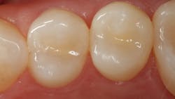 Lowe Figure 4 6206db865647d Lowe Figure 4 6206db865647d