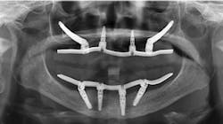 Figure4 621ff415e2a75 Figure4 621ff415e2a75