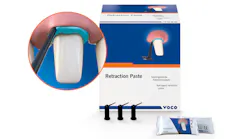 Retraction Paste 3400x3400