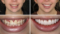 Screen Shot 2022 04 01 At 4 20 13 Pm 62476cae66a70 Screen Shot 2022 04 01 At 4 20 13 Pm 62476cae66a70