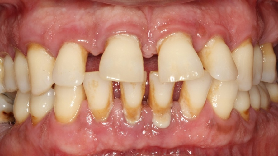 Figure5 627408f5601f8