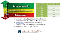 Figure 3: Osteopenia and osteoporosis are often overlooked in diagnostic procedures. Poor bone density has a guarded potential for implant placement. Figure 3: Osteopenia and osteoporosis are often overlooked in diagnostic procedures. Poor bone density has a guarded potential for implant placement.