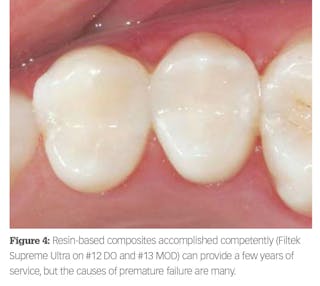 A Review of Light-Curing Considerations for Resin-Based Composite