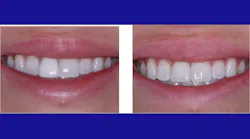 Figure1 Rev
