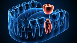 Getty Images 1254343544 6345ceb0c907f 635814da3aa8e Getty Images 1254343544 6345ceb0c907f 635814da3aa8e