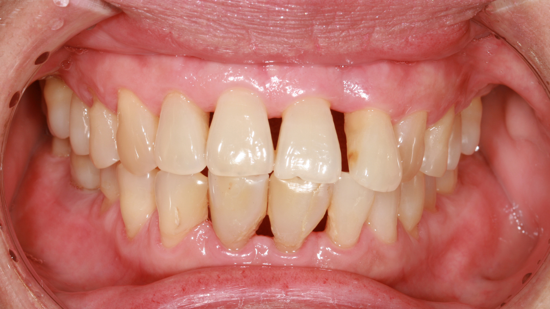 Microsoft Teams Image (43)