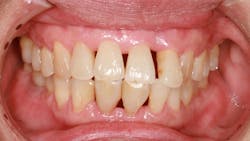 Microsoft Teams Image 43 634ff5d0e3552 Microsoft Teams Image 43 634ff5d0e3552